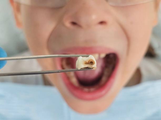 Best Cracked Tooth Emergency Dentist  in Big Pine, CA